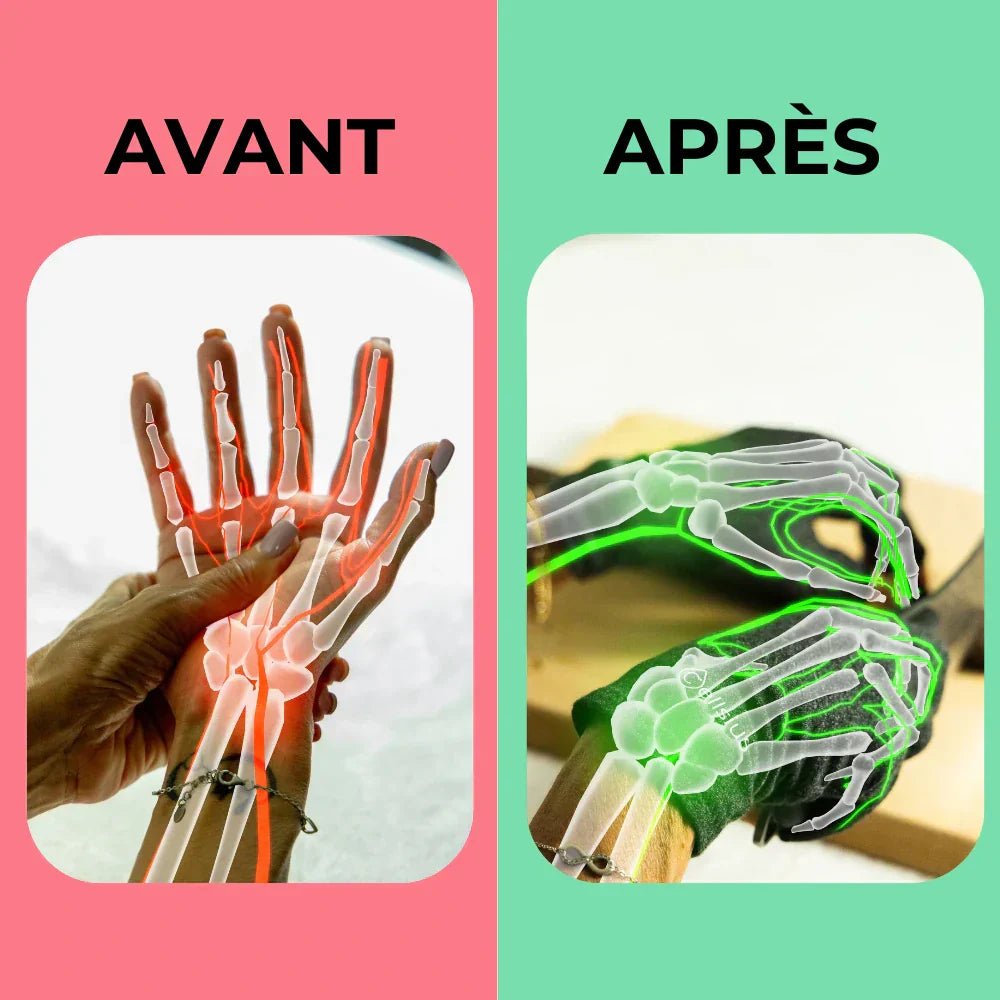 Gants de Mobilité Cellsius - Libérez vos mains de la douleur - FR - CELLSIUS.